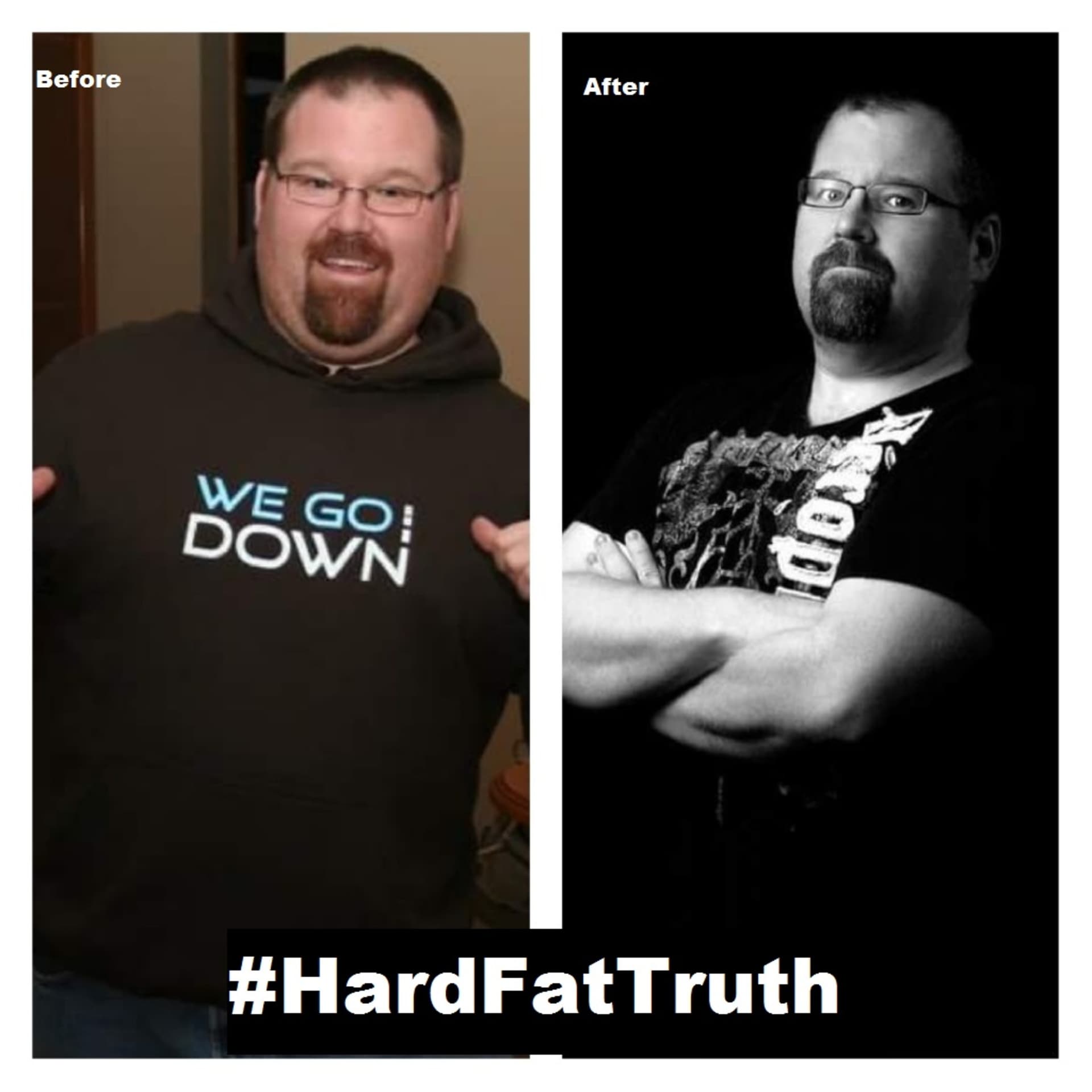 Hard Fat Truth - Podcasts